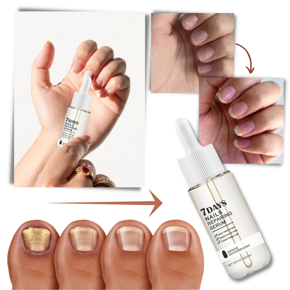 7 Days Nail Repair Essence