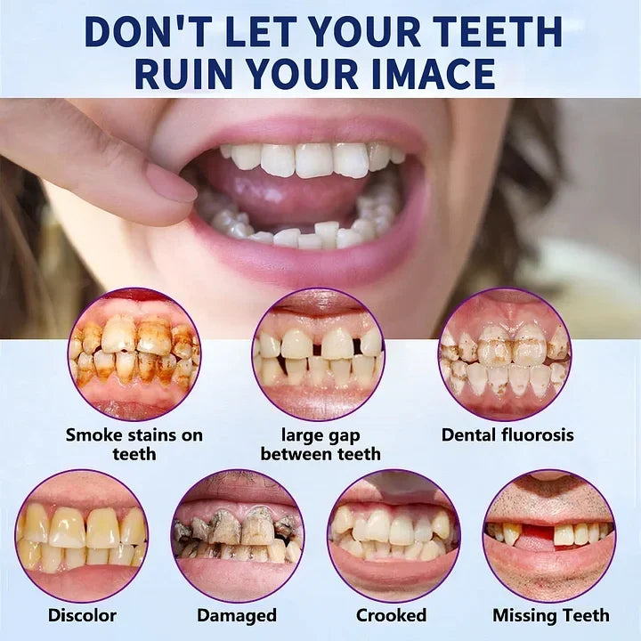 Flexible Full Denture