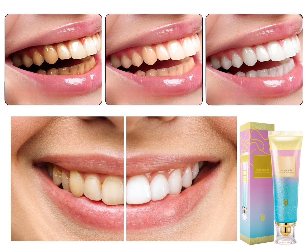 Niacinamide Whitening Toothpaste with Triple Whitening Complex