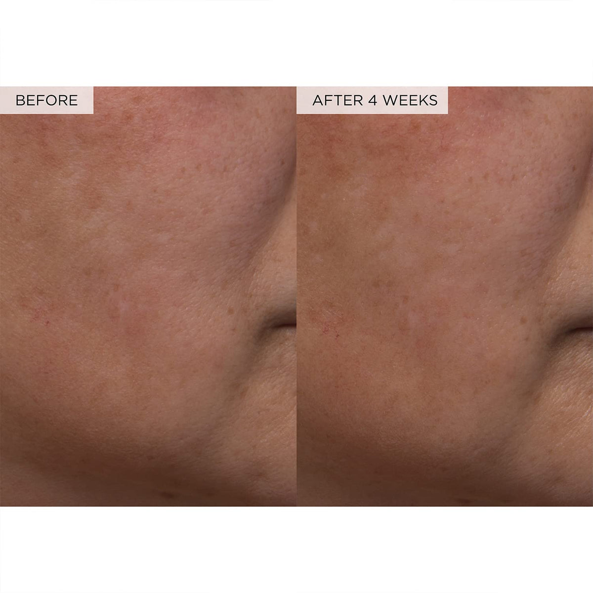 PHA + BHA Pore Tight Toner with Watermelon Extract & Glycerin for Pore