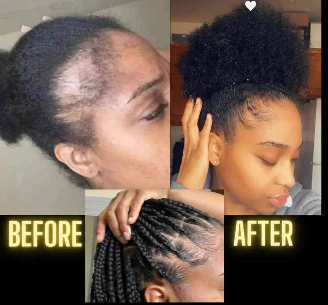 Moisturize & Seal Bundle for Dry Hair, Scalp Care and Fuller-Looking Hair