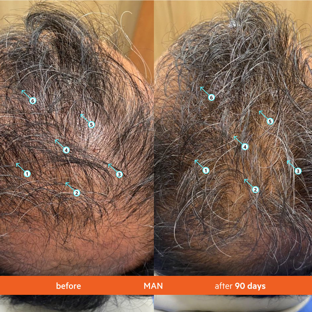 Hair Density Thickening Shampoo with Biotin and Caffeine for Fuller Hair