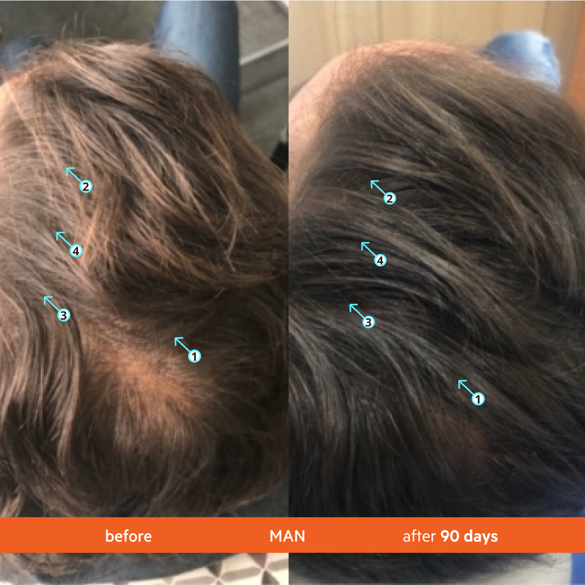 Hair Density Thickening Shampoo with Biotin and Caffeine for Fuller Hair
