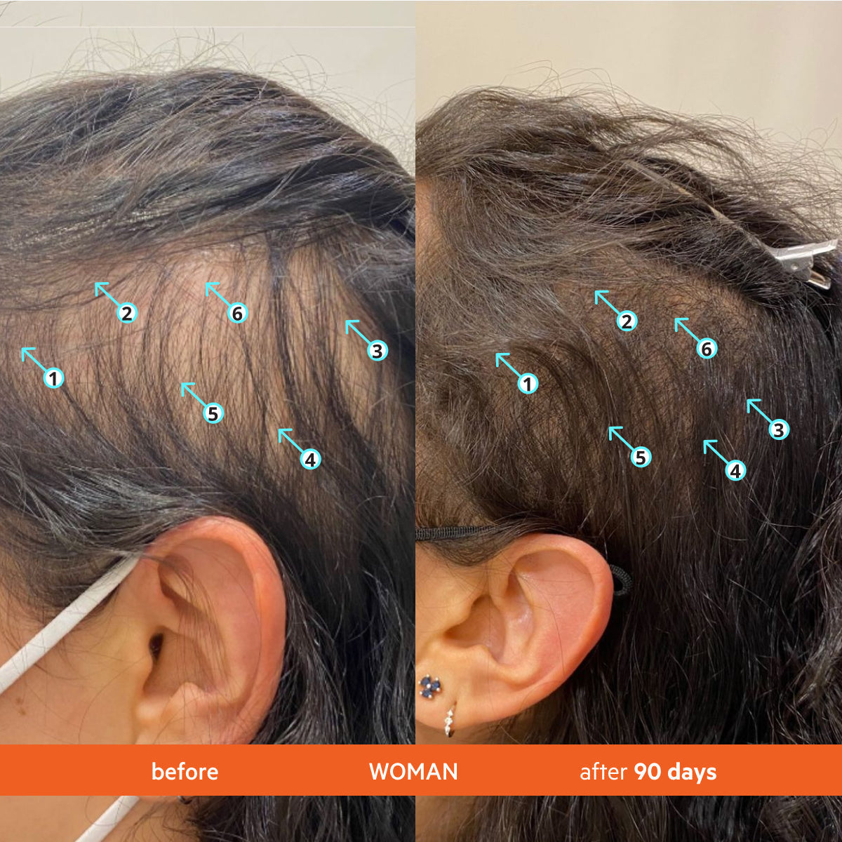 Hair Density Thickening Shampoo with Biotin and Caffeine for Fuller Hair