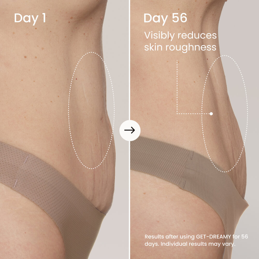 GET-DREAMY Overnight Body Whip with Caffeine, Peptides & Magnesium for Uneven Skin Texture
