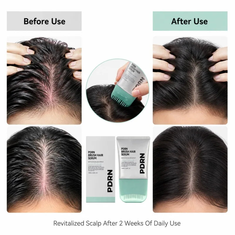 PDRN Scalp Serum 100ml with Cooling Brush Applicator – Nourishing Scalp Care