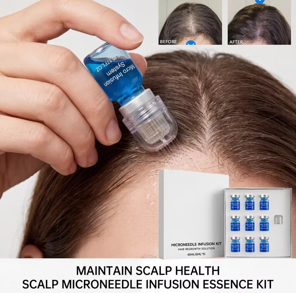 Microneedle Scalp Care Kit with 9 x 5ml Nourishing Scalp Serum and 0.2mm Needle Head