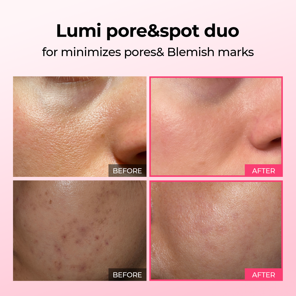Lumi Pore & Spot Care Serum Duo Set for Pores, Dark Spots & Pigmentation